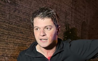 Brutální napadení gruzínského politika!